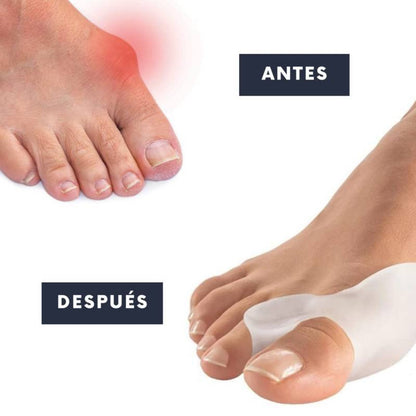 Corrector De Juanetes Pro Medical Para Noche Y Dia